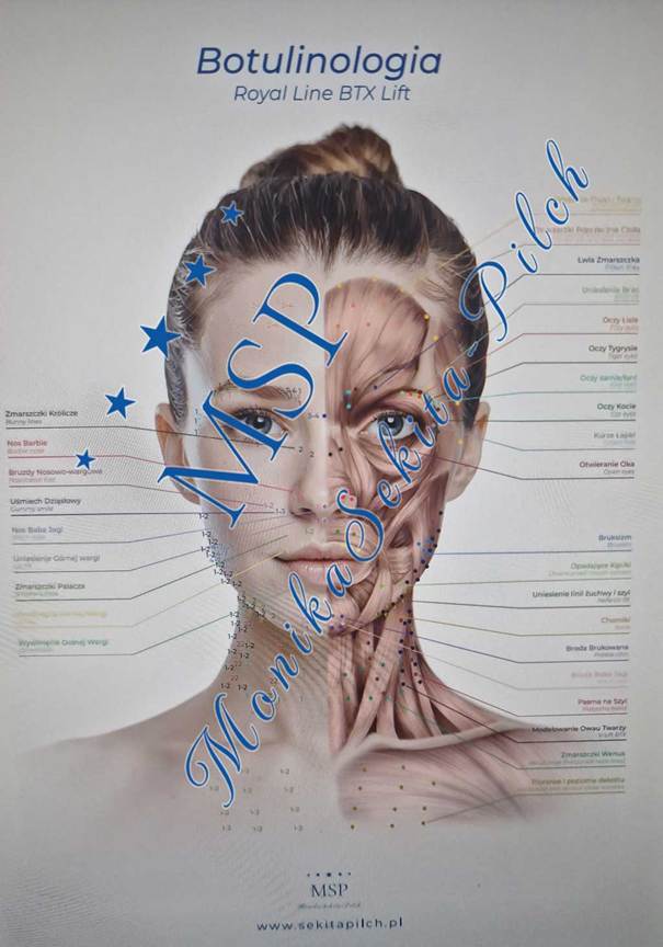 You are currently viewing Plakat edukacyjny „Botulinologia”